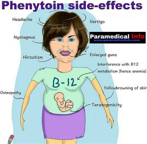 Phenytoin Side Effects | Medical student study, Nurse study notes ...