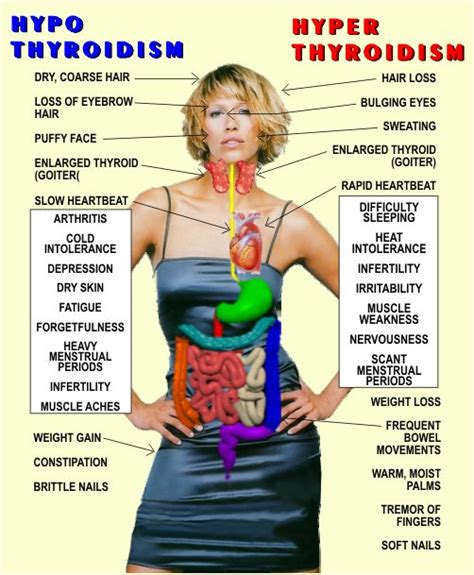 HYPOTHYROIDISM VS HYPERTHYROIDISM | THINK THYROID