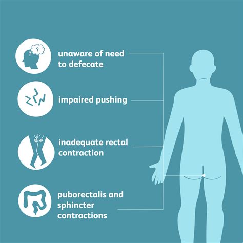 Types Of Pelvic Floor Dyssynergia | Viewfloor.co