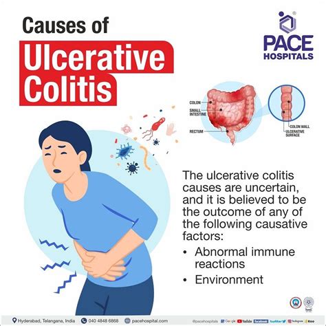 Ulcerative Colitis – Symptoms, Causes, Types and Complications