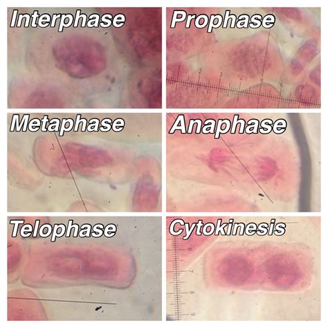 Mitosis Stages Under Microscope Labeled - Micropedia