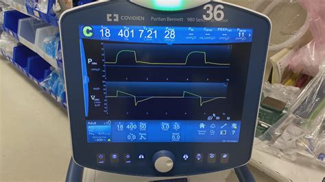 Regions Hospital tests new ventilator tech from Medtronic | kare11.com