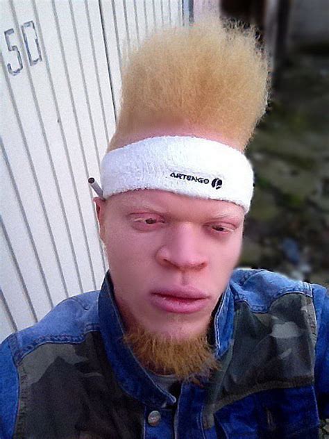 For those who wanted to see a black ginger albino person this is Tikeboss - 9GAG