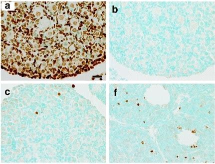 TUNEL staining methods and kits | Abcam