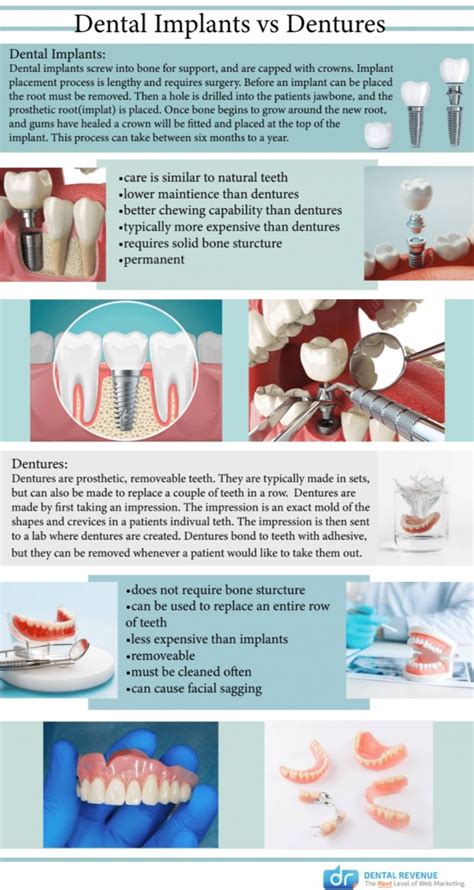 Dental Implants vs Dentures | Cosmetic & Advanced Dentistry