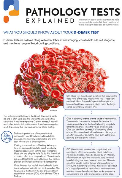 D-dimer | Pathology Tests Explained