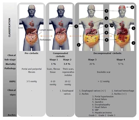 Liver Cirrhosis Stages