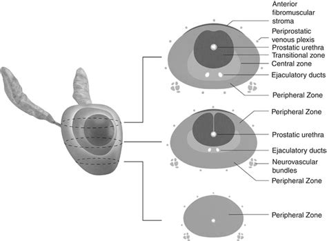 Prostate Anatomy Lobes