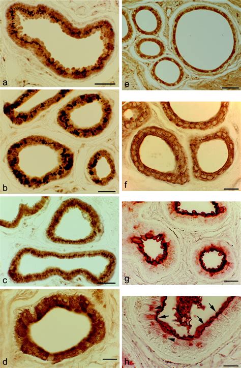 Ceruminous Glands Histology