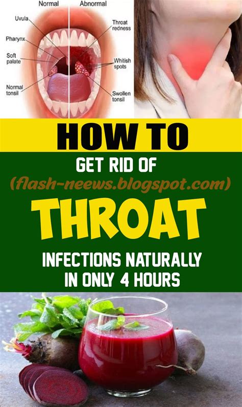 Instructions to Get Rid of Throat Infections Naturally in Only 4 Hours