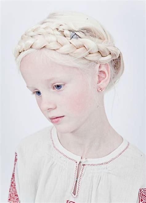 200 best beautiful albino people! images on Pinterest | Albinism, Faces ...