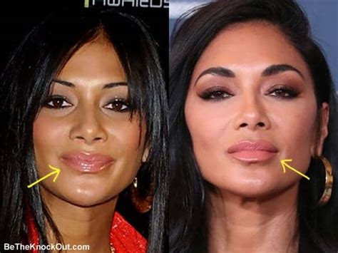 Nicole Scherzinger Nose Job Before And After