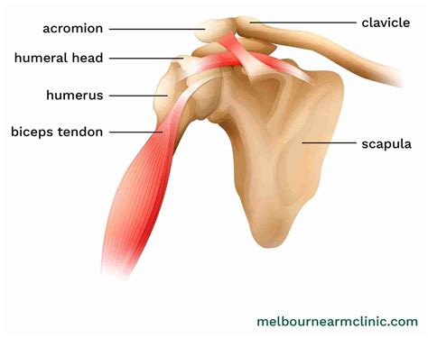 Bicep Tendon Tear at the Shoulder (Signs & Symptoms)