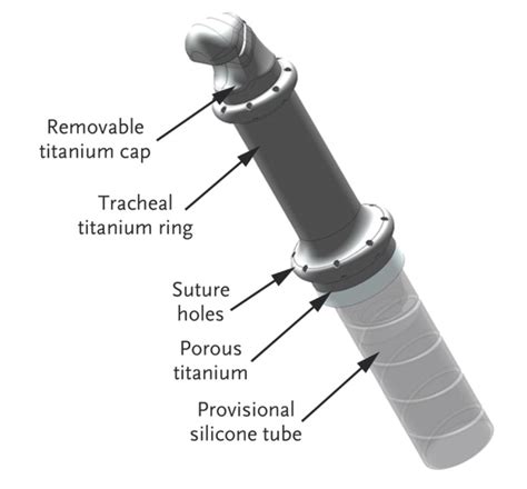 The Artificial Larynx