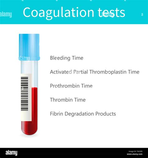 Coagulation tests, illustration Stock Photo - Alamy