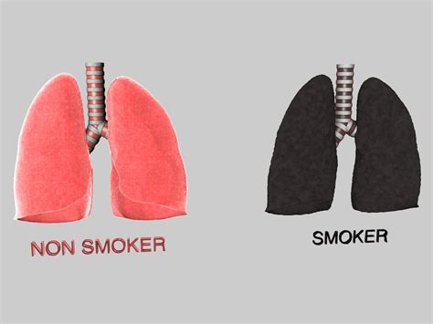 Smokers Lungs Vs Non Smokers Lungs