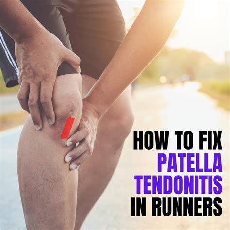 How to fix Patella Tendonitis in Runners | Matthew Boyd Physio