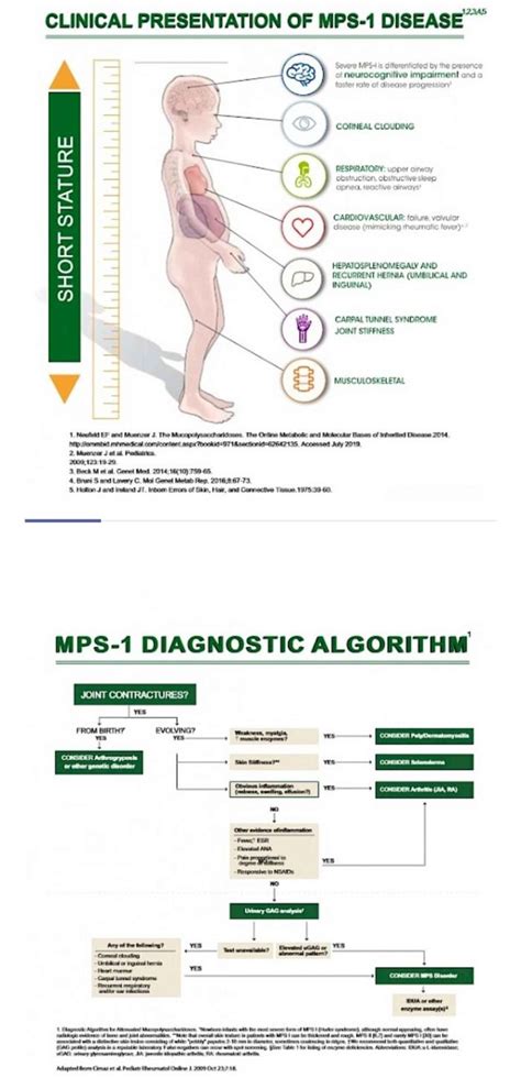 How to diagnose MPS I Disease