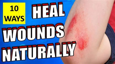 10 Natural Ways To Heal Wounds And Scrapes Fast & Quickly - Epic Natural Health