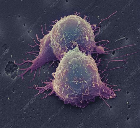 Lung cancer cell division - Stock Image - M132/0600 - Science Photo Library