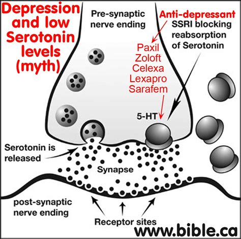 Anti-psychotic drugs cause permanent brain damage