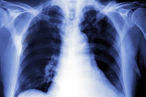 Which types of X-rays & scans have the most radiation? - Qoctor, the online doctor.