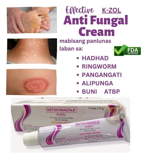 EFFECTIVE Anti fungal Cream K.ZOL. LUNAS PARA SA HADHAD BUNI RINGWORM ALIPUNGA ATHLETE'S FOOT ...