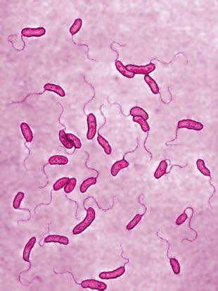 Vibrio cholerae | Comma Bacillus | Curved bacilli singly, Comma shape ...