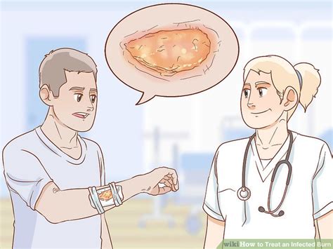 3 Ways to Treat an Infected Burn - wikiHow