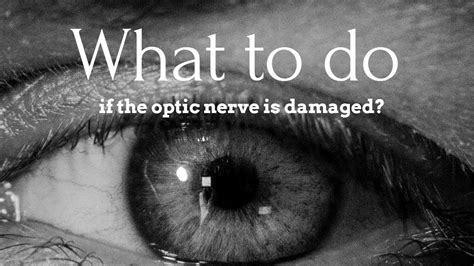 What to do if the optic nerve is damaged ? - YouTube