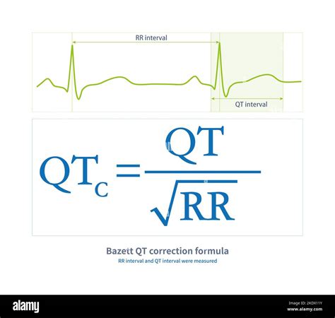 Bazett QT correction formula, illustration Stock Photo - Alamy