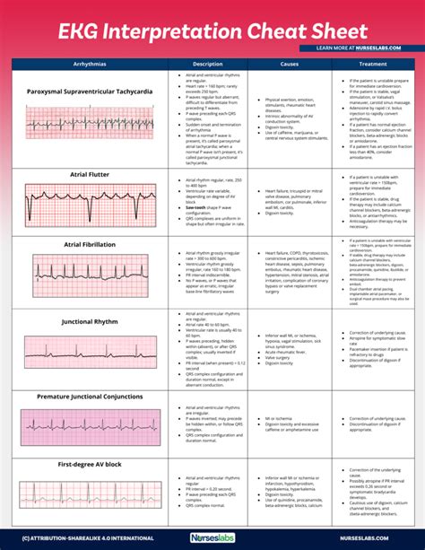 EKG Interpretation Cheat Sheet (Free Download) | Ekg interpretation cheat sheets, Ekg ...