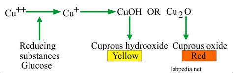 Diabetes Mellitus:- Part 5 – Glucose in Urine (Glycosuria), Urine Sugar ...