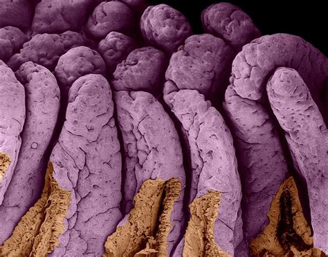 Villi Of The Small Intestine Photograph by Dennis Kunkel Microscopy/science Photo Library - Pixels