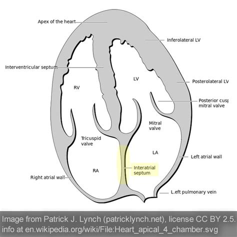 Interatrial Septum (Heart Structure)