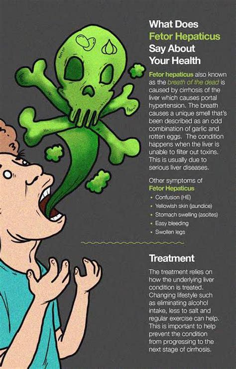 Treatment of fetor hepaticus - MEDizzy