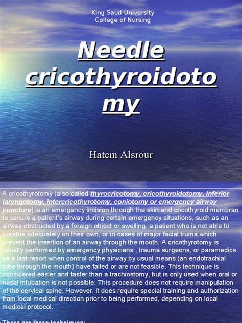 Needle Cricothyroidotomy | Clinical Medicine | Traumatology | Free 30 ...