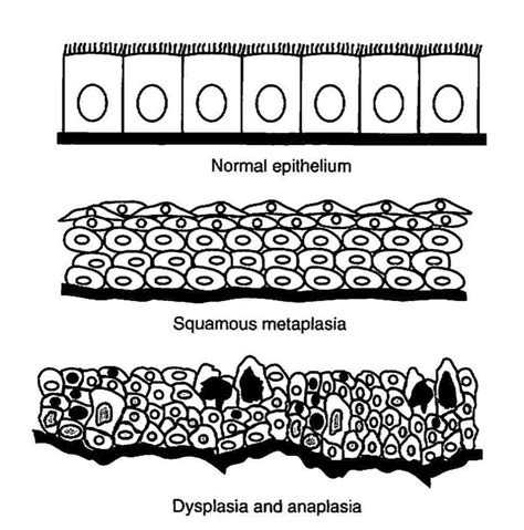 Carcinogenesis - Toxicologic Pathology