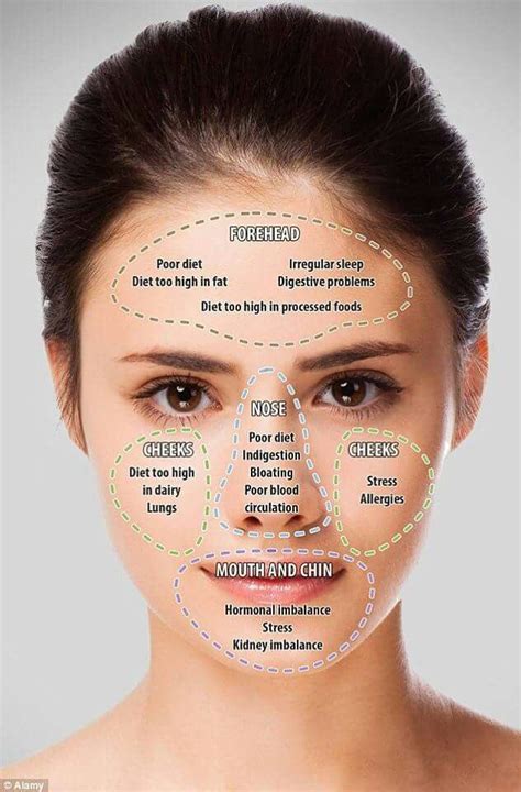 Acné #face #cutis | Face acne, Face mapping acne, Natural skin care