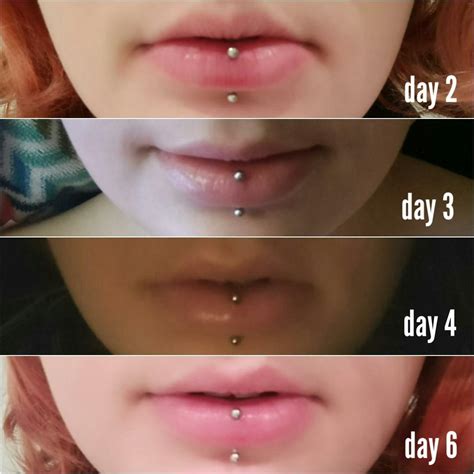 Vertical labret first week swelling. Healing well so far, day 4 was ...