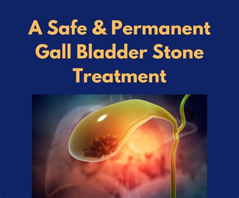 Gall Bladder Stone Treatment In Vijayawada AP