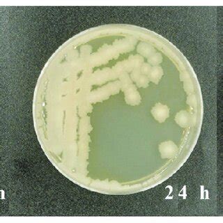 Colony morphology on LB solid media containing 10 µg/L of AFB 1 after... | Download Scientific ...