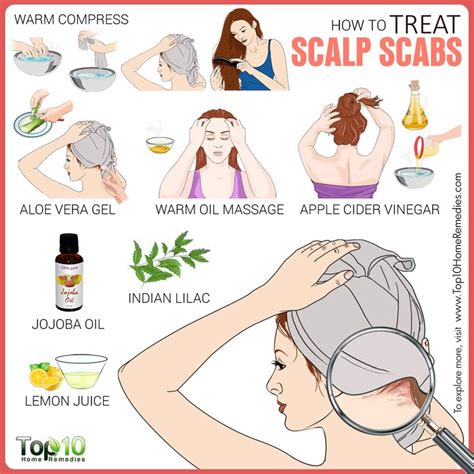 How to Treat Scalp Scabs | Top 10 Home Remedies | Scalp scabs, Dry ...