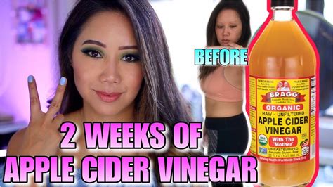 Bragg Apple Cider Vinegar For Weight Loss | Blog Dandk