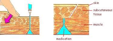 Intramuscular Injections: Z-Track Method of Intramuscular Injection