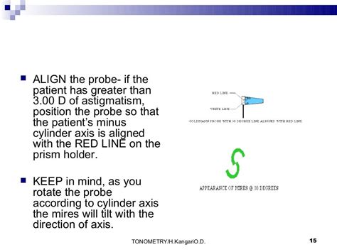 Goldman applanation tonometry