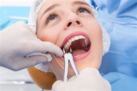 Multiple Dental Extraction Procedure at Sally Marlon blog