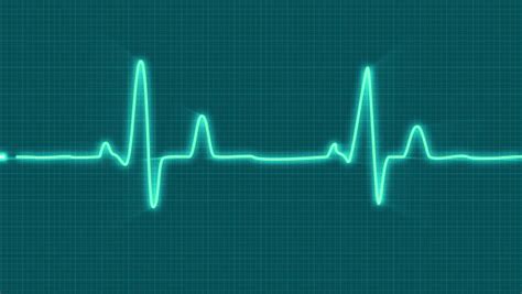 Looped Animated Ecg Electrocardiogram Display. Stock Footage Video (100% Royalty-free) 14718187 ...