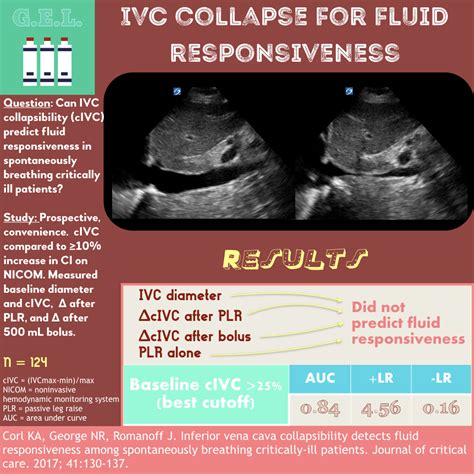 emDOCs.net – Emergency Medicine EducationUltrasound G.E.L. - Inferior Vena Cava Collapsibility ...