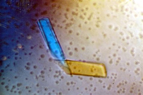 Quantitative Bence-Jones Protein Test